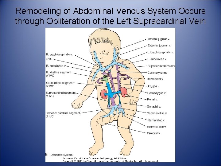 Remodeling of Abdominal Venous System Occurs through Obliteration of the Left Supracardinal Vein 