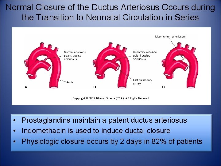 Normal Closure of the Ductus Arteriosus Occurs during the Transition to Neonatal Circulation in