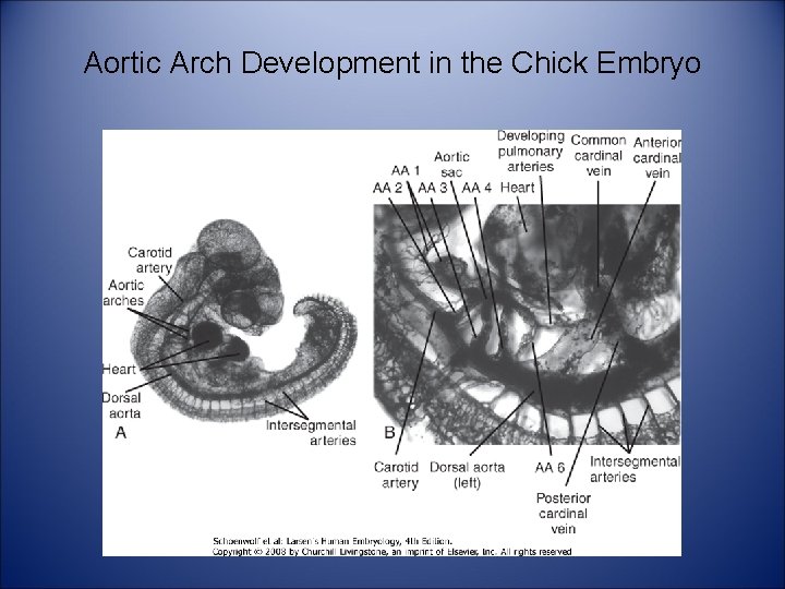 Aortic Arch Development in the Chick Embryo 