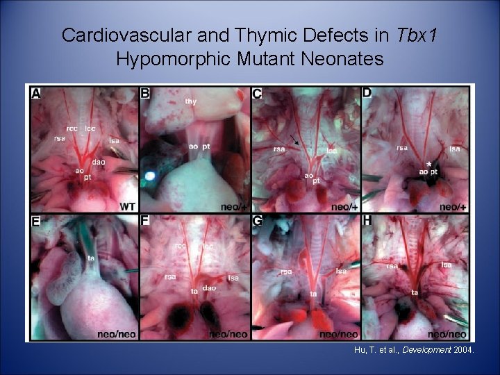 Cardiovascular and Thymic Defects in Tbx 1 Hypomorphic Mutant Neonates Hu, T. et al.