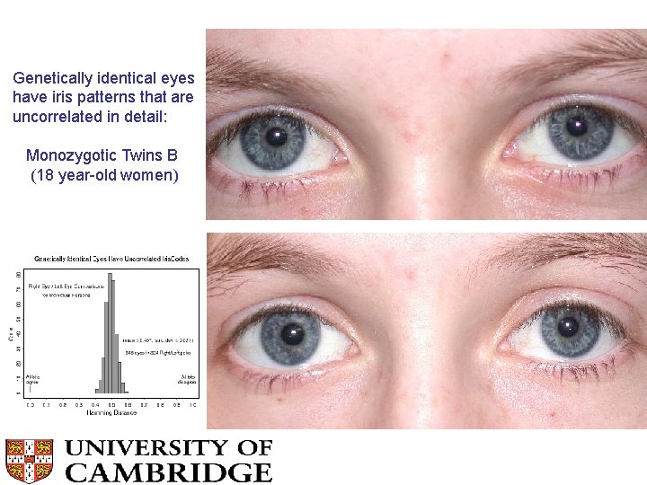 Genetically identical eyes have iris patterns that are uncorrelated in detail: Monozygotic Twins B