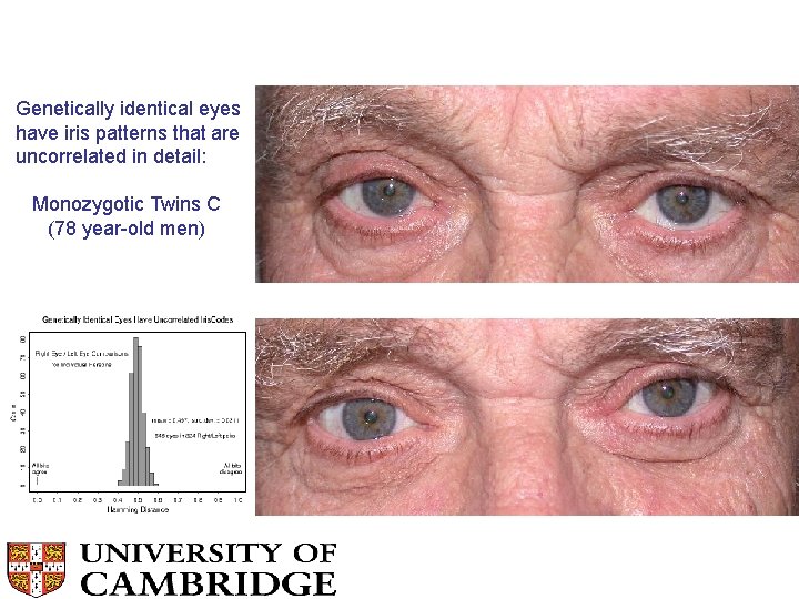 Genetically identical eyes have iris patterns that are uncorrelated in detail: Monozygotic Twins C