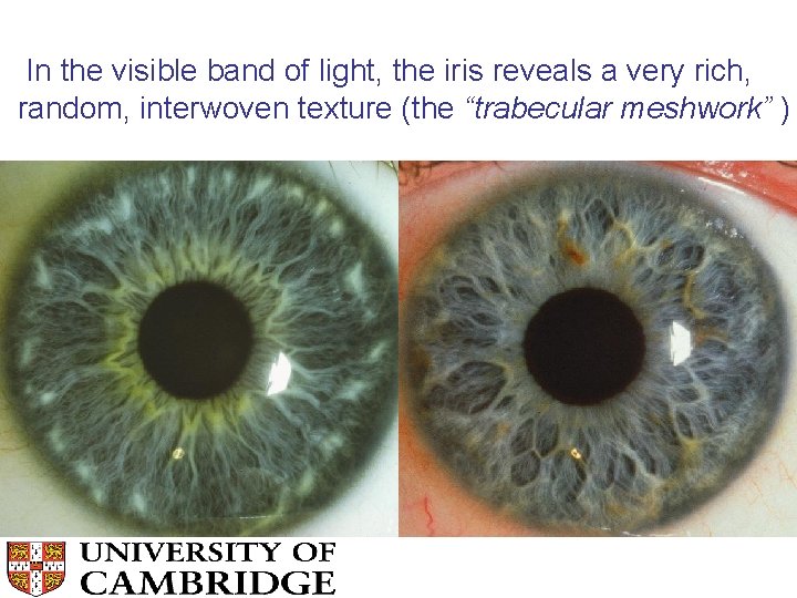 In the visible band of light, the iris reveals a very rich, random, interwoven