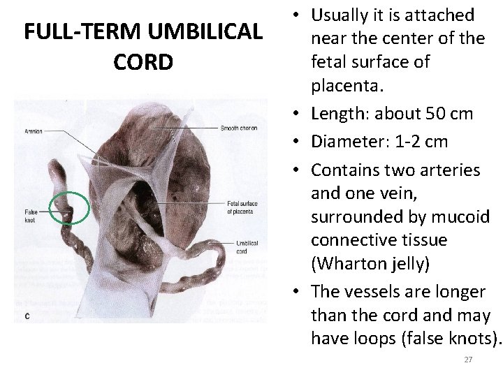 FULL-TERM UMBILICAL CORD • Usually it is attached near the center of the fetal