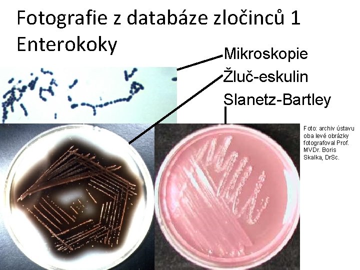 Fotografie z databáze zločinců 1 Enterokoky Mikroskopie Žluč-eskulin Slanetz-Bartley Foto: archiv ústavu oba levé