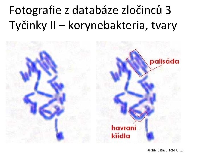 Fotografie z databáze zločinců 3 Tyčinky II – korynebakteria, tvary archiv ústavu, foto O.