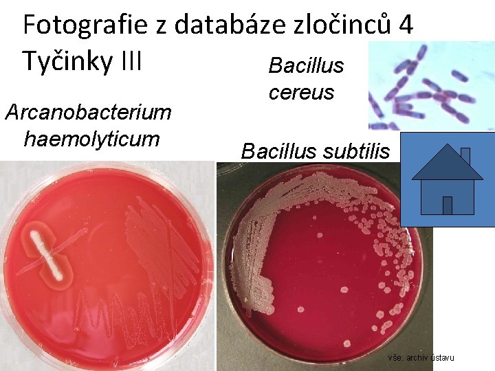 Fotografie z databáze zločinců 4 Tyčinky III Bacillus Arcanobacterium haemolyticum cereus Bacillus subtilis vše: