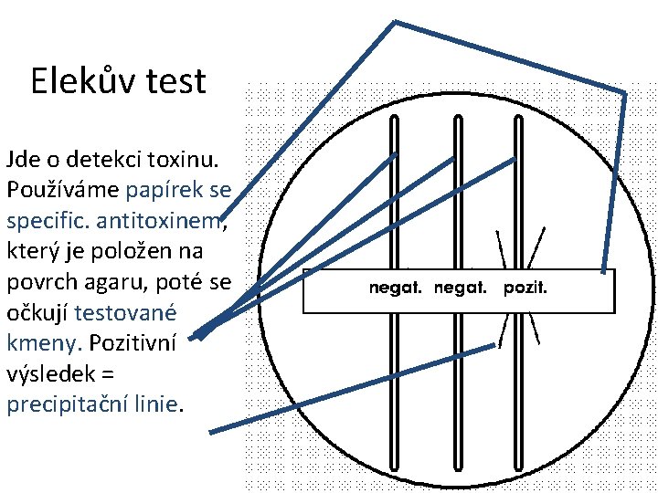 Elekův test Jde o detekci toxinu. Používáme papírek se specific. antitoxinem, který je položen