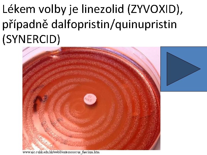 Lékem volby je linezolid (ZYVOXID), případně dalfopristin/quinupristin (SYNERCID) www. aic. cuhk. edu. hk/web 8/enterococcus_faecium.