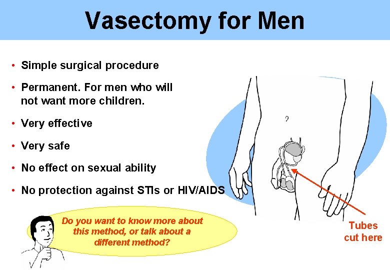 Vasectomy for Men • Simple surgical procedure • Permanent. For men who will not