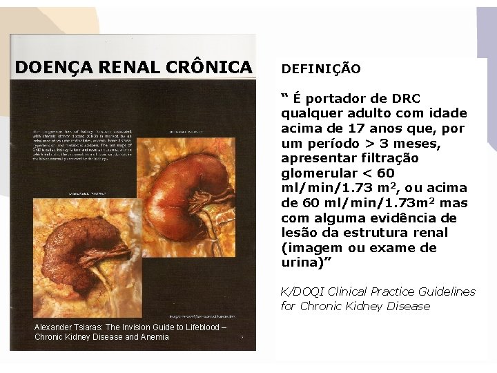 DOENÇA RENAL CRÔNICA DEFINIÇÃO “ É portador de DRC qualquer adulto com idade acima