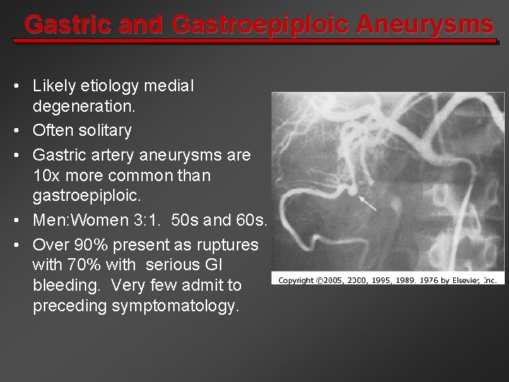 Gastric and Gastroepiploic Aneurysms • Likely etiology medial degeneration. • Often solitary • Gastric