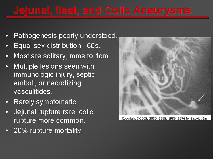 Jejunal, Ileal, and Colic Aneurysms • • Pathogenesis poorly understood. Equal sex distribution. 60