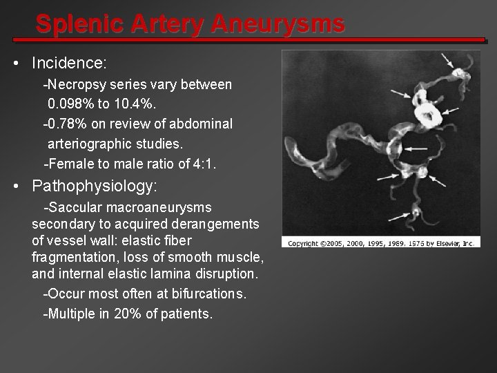 Splenic Artery Aneurysms • Incidence: -Necropsy series vary between 0. 098% to 10. 4%.