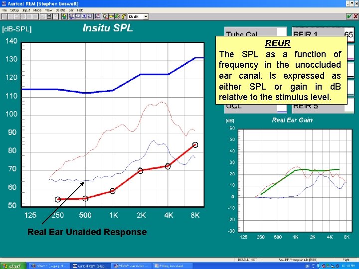 REUR The SPL as a function of frequency in the unoccluded ear canal. Is