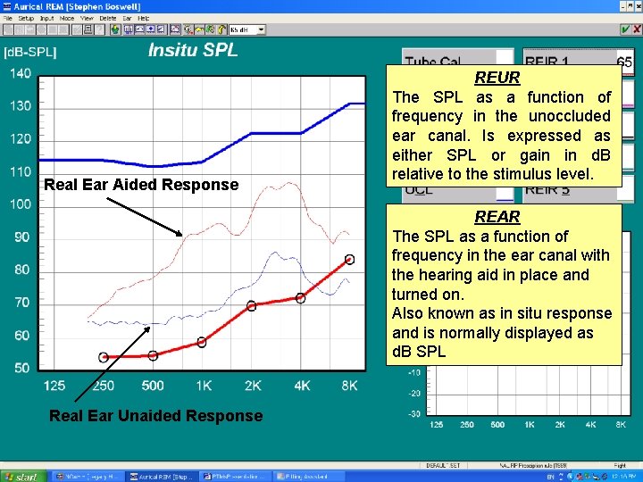 Real Ear Aided Response REUR The SPL as a function of frequency in the