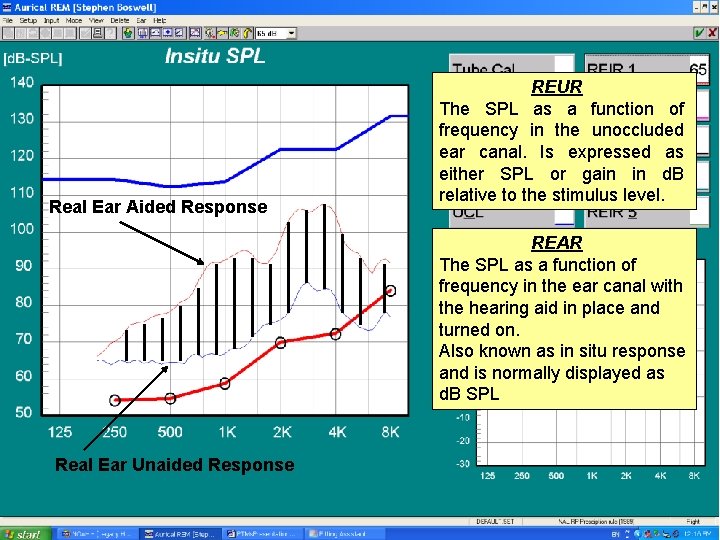 Real Ear Aided Response REUR The SPL as a function of frequency in the