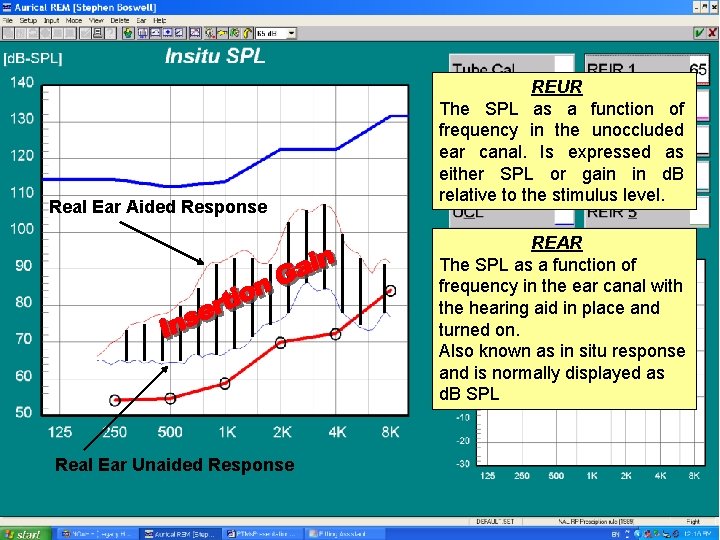 Real Ear Aided Response REUR The SPL as a function of frequency in the