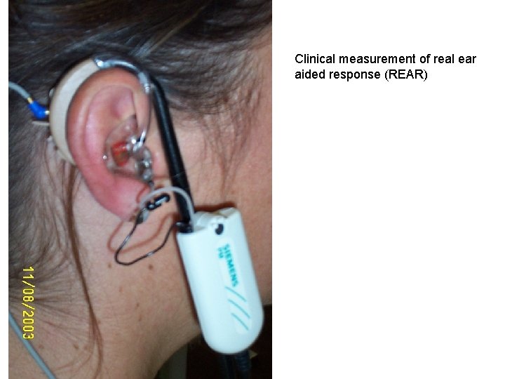 Clinical measurement of real ear aided response (REAR) 
