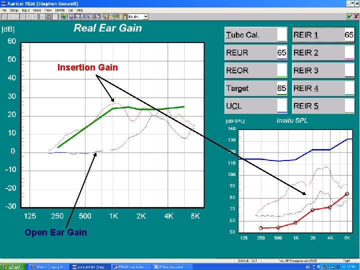 Insertion Gain Open Ear Gain 