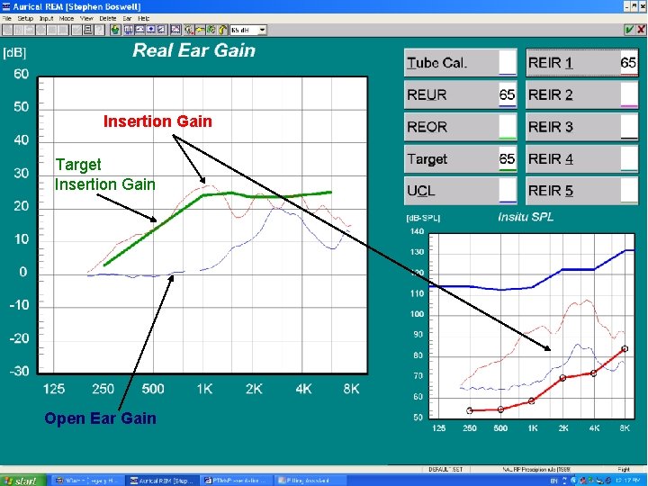 Insertion Gain Target Insertion Gain Open Ear Gain 