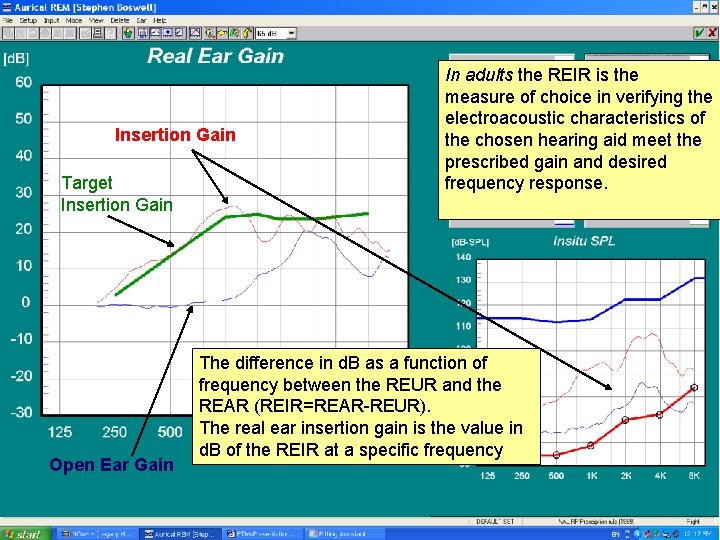 Insertion Gain Target Insertion Gain Open Ear Gain In adults the REIR is the