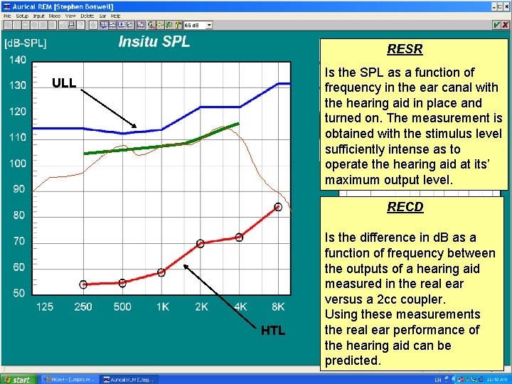 RESR Is the SPL as a function of frequency in the ear canal with