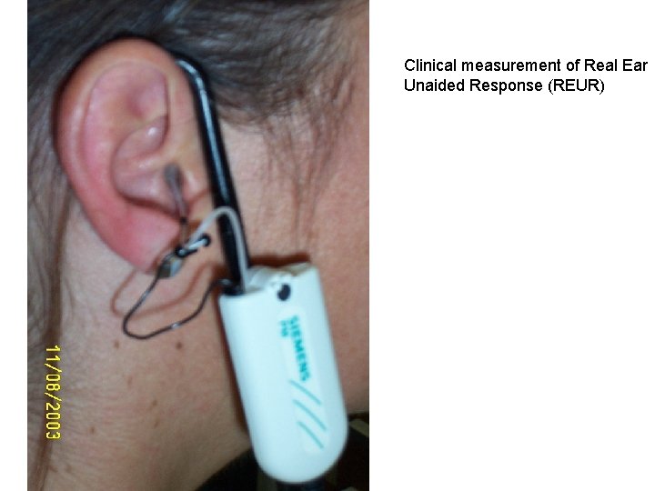 Clinical measurement of Real Ear Unaided Response (REUR) 