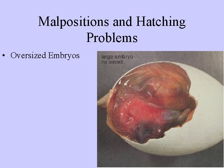 Malpositions and Hatching Problems • Oversized Embryos 