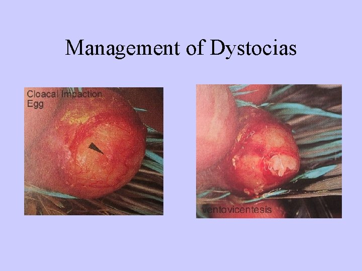 Management of Dystocias 