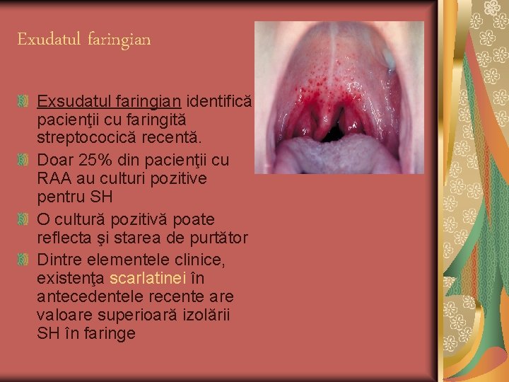 Exudatul faringian Exsudatul faringian identifică pacienţii cu faringită streptococică recentă. Doar 25% din pacienţii