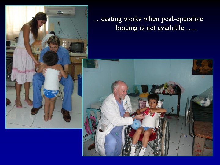 …casting works when post-operative bracing is not available …. . 