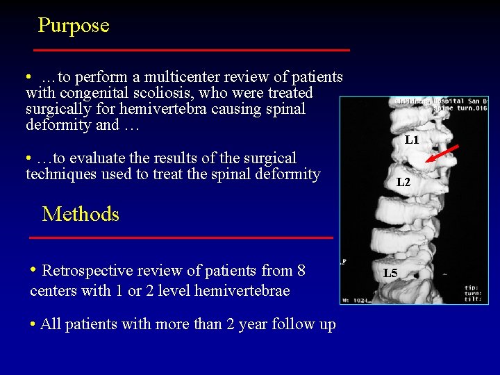 Purpose • …to perform a multicenter review of patients with congenital scoliosis, who were