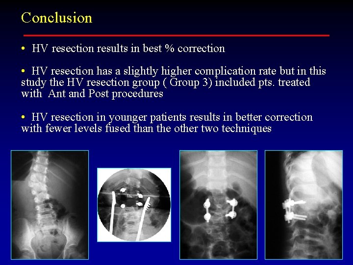 Conclusion • HV resection results in best % correction • HV resection has a