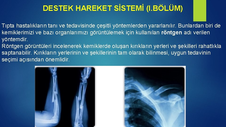 DESTEK HAREKET SİSTEMİ (I. BÖLÜM) Tıpta hastalıkların tanı ve tedavisinde çeşitli yöntemlerden yararlanılır. Bunlardan