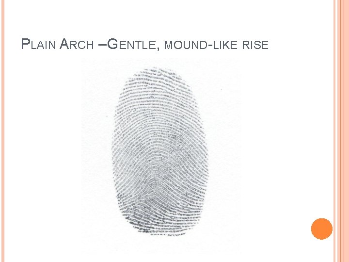 PLAIN ARCH – GENTLE, MOUND-LIKE RISE 