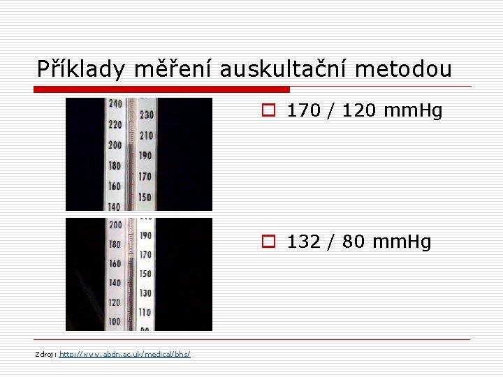 Příklady měření auskultační metodou o 170 / 120 mm. Hg o 132 / 80
