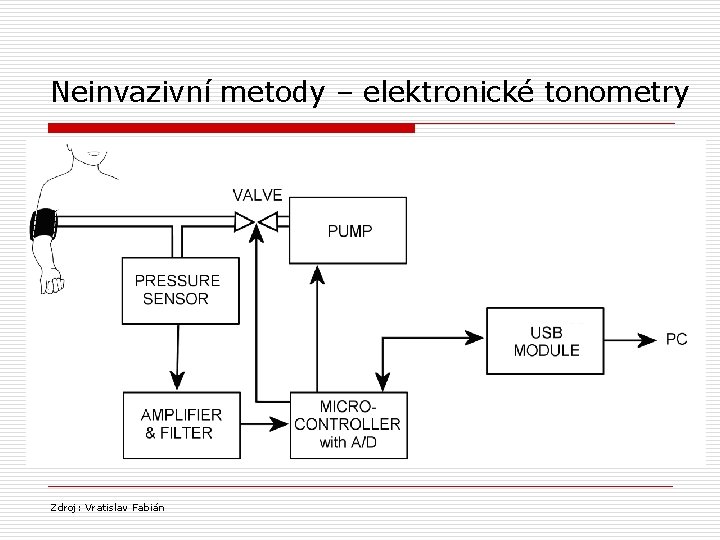 Neinvazivní metody – elektronické tonometry Zdroj: Vratislav Fabián 