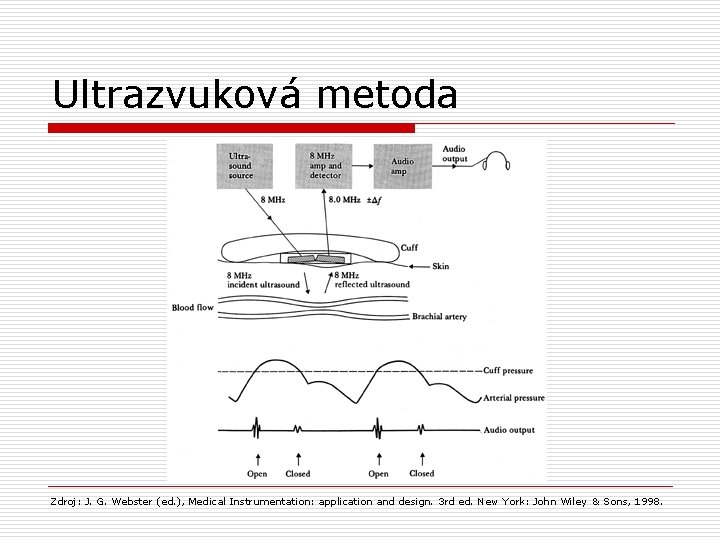Ultrazvuková metoda Zdroj: J. G. Webster (ed. ), Medical Instrumentation: application and design. 3
