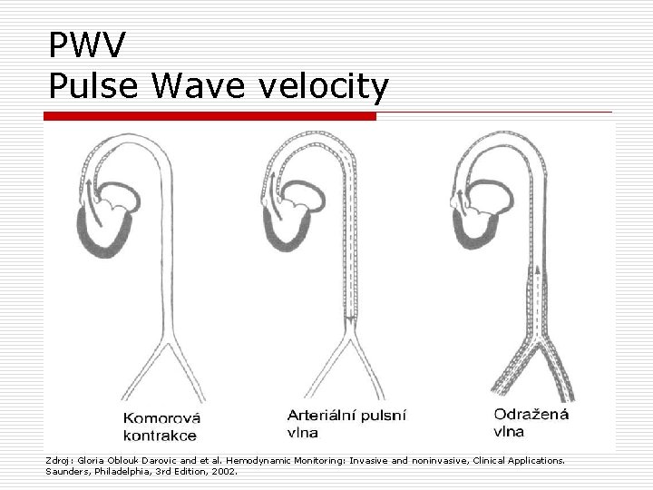 PWV Pulse Wave velocity Zdroj: Gloria Oblouk Darovic and et al. Hemodynamic Monitoring: Invasive