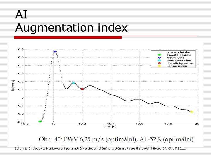 AI Augmentation index Zdroj: L. Chaloupka, Monitorování parametrů kardiovaskulárního systému z tvaru tlakových křivek,