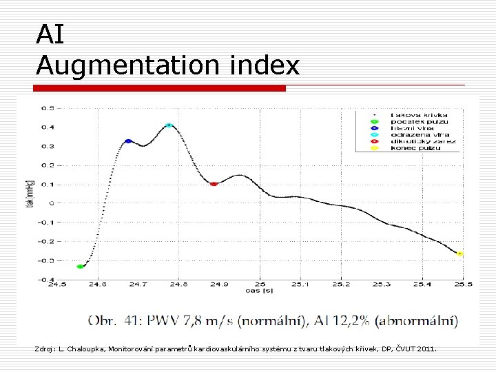 AI Augmentation index Zdroj: L. Chaloupka, Monitorování parametrů kardiovaskulárního systému z tvaru tlakových křivek,