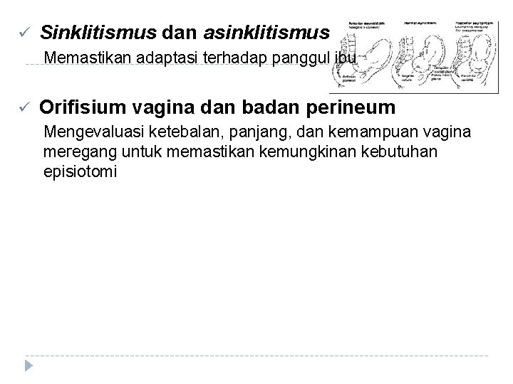 ü Sinklitismus dan asinklitismus Memastikan adaptasi terhadap panggul ibu ü Orifisium vagina dan badan ü Sinklitismus dan asinklitismus Memastikan adaptasi terhadap panggul ibu ü Orifisium vagina dan badan