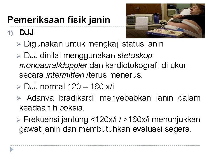 Pemeriksaan fisik janin 1) DJJ Ø Digunakan untuk mengkaji status janin Ø DJJ dinilai Pemeriksaan fisik janin 1) DJJ Ø Digunakan untuk mengkaji status janin Ø DJJ dinilai