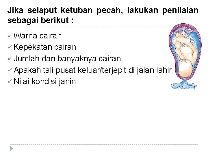 Jika selaput ketuban pecah, lakukan penilaian sebagai berikut : ü Warna cairan ü Kepekatan Jika selaput ketuban pecah, lakukan penilaian sebagai berikut : ü Warna cairan ü Kepekatan