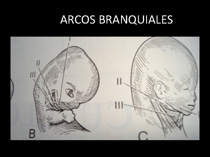 ARCOS BRANQUIALES 