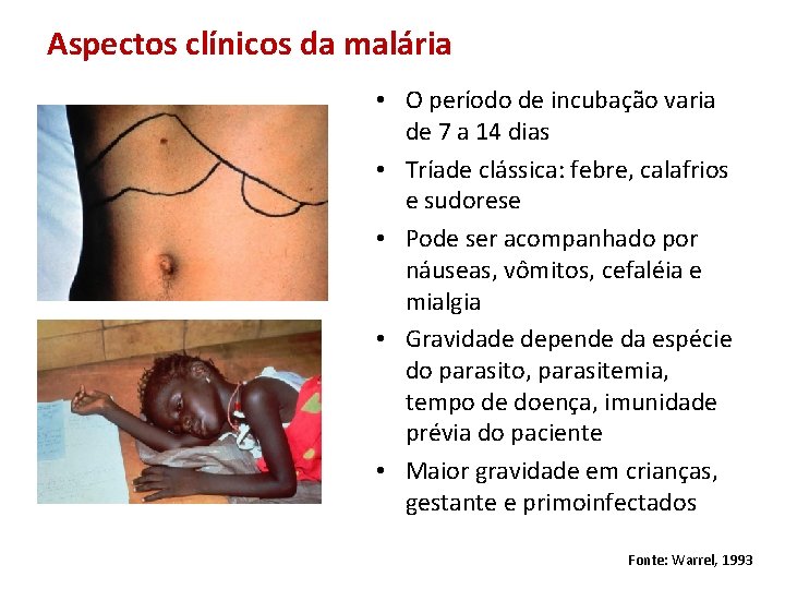 Aspectos clínicos da malária • O período de incubação varia de 7 a 14