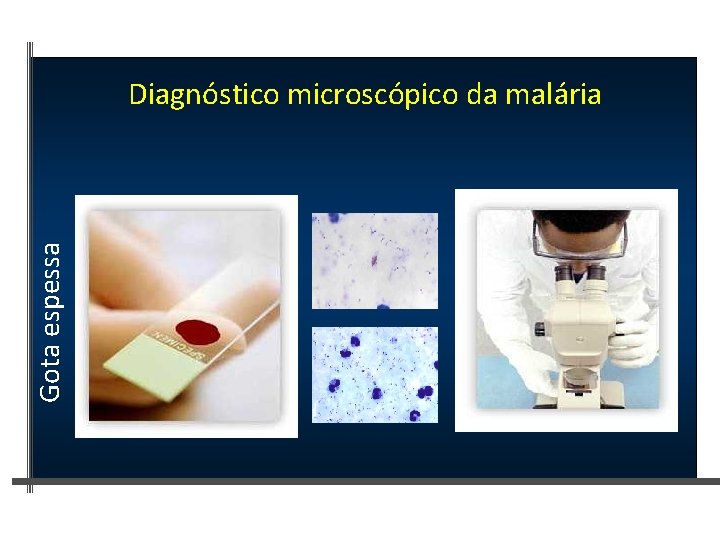 Gota espessa Diagnóstico microscópico da malária 