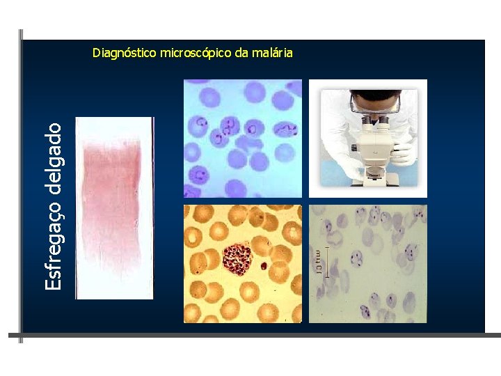 Esfregaço delgado Diagnóstico microscópico da malária 