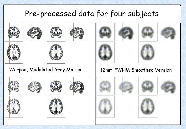 Pre-processed data for four subjects Warped, Modulated Grey Matter 12 mm FWHM Smoothed Version